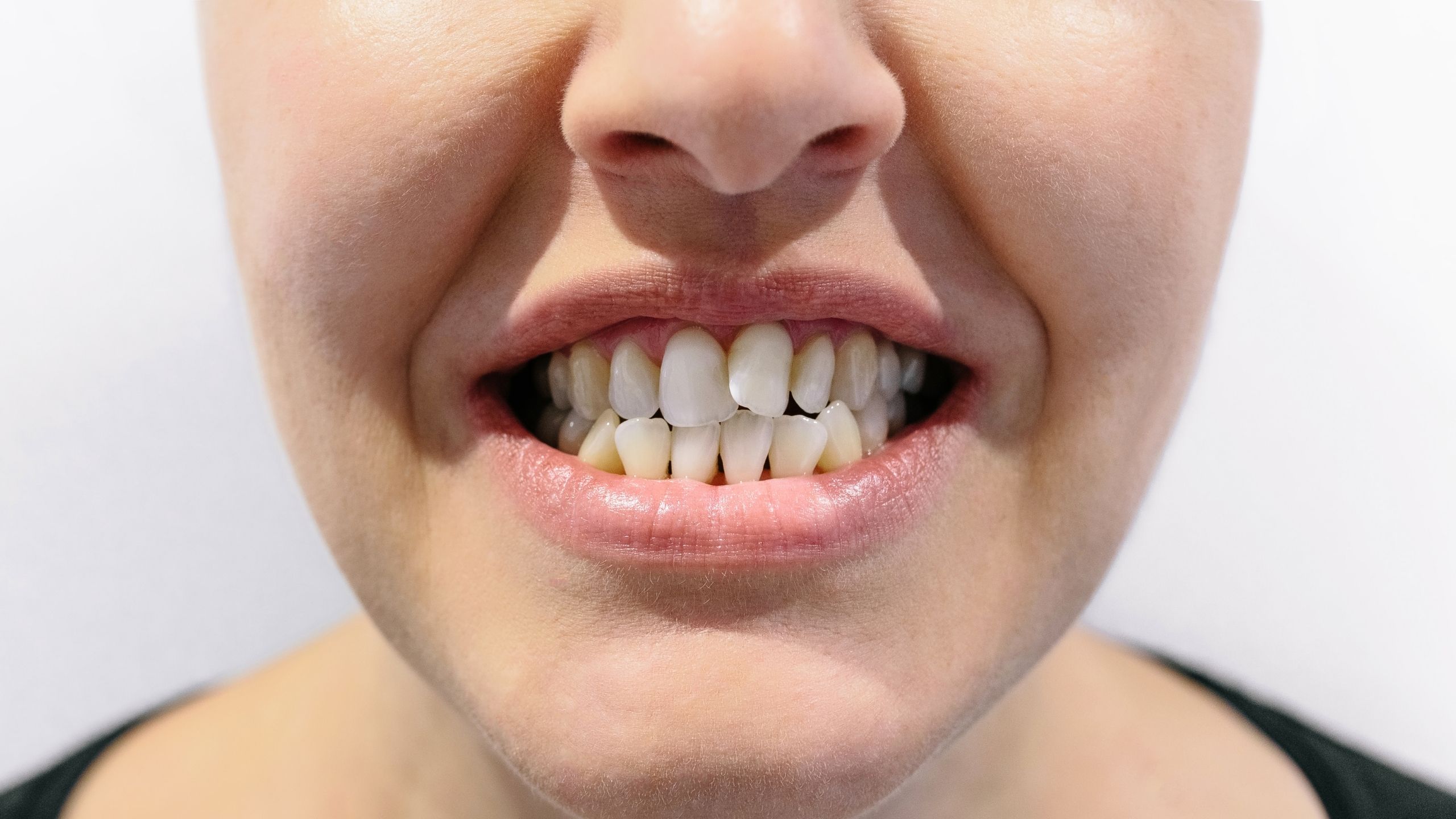 Koruyucu Diş Hekimliği ve Ortodonti