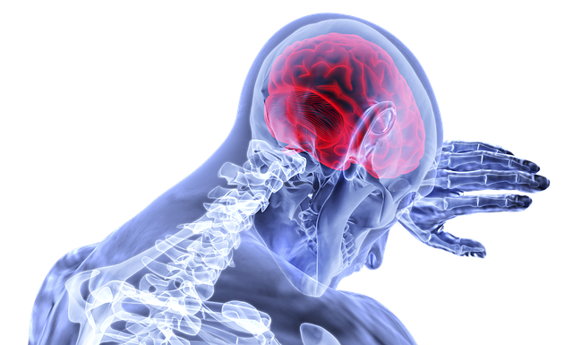 Uyanık Beyin Tümörü Ameliyatı İle Kalıcı Hasarların Önlenmesi